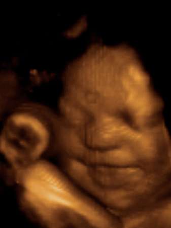 Unborn Baby Pictures on Unborn Child Smiling Unborn 40 Weeks